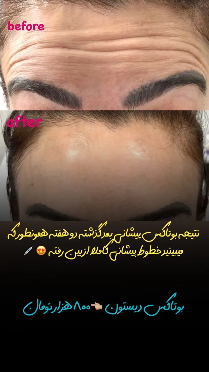 مرکز لیزر و کلینیک زیبایی پریفا - تصویر 2