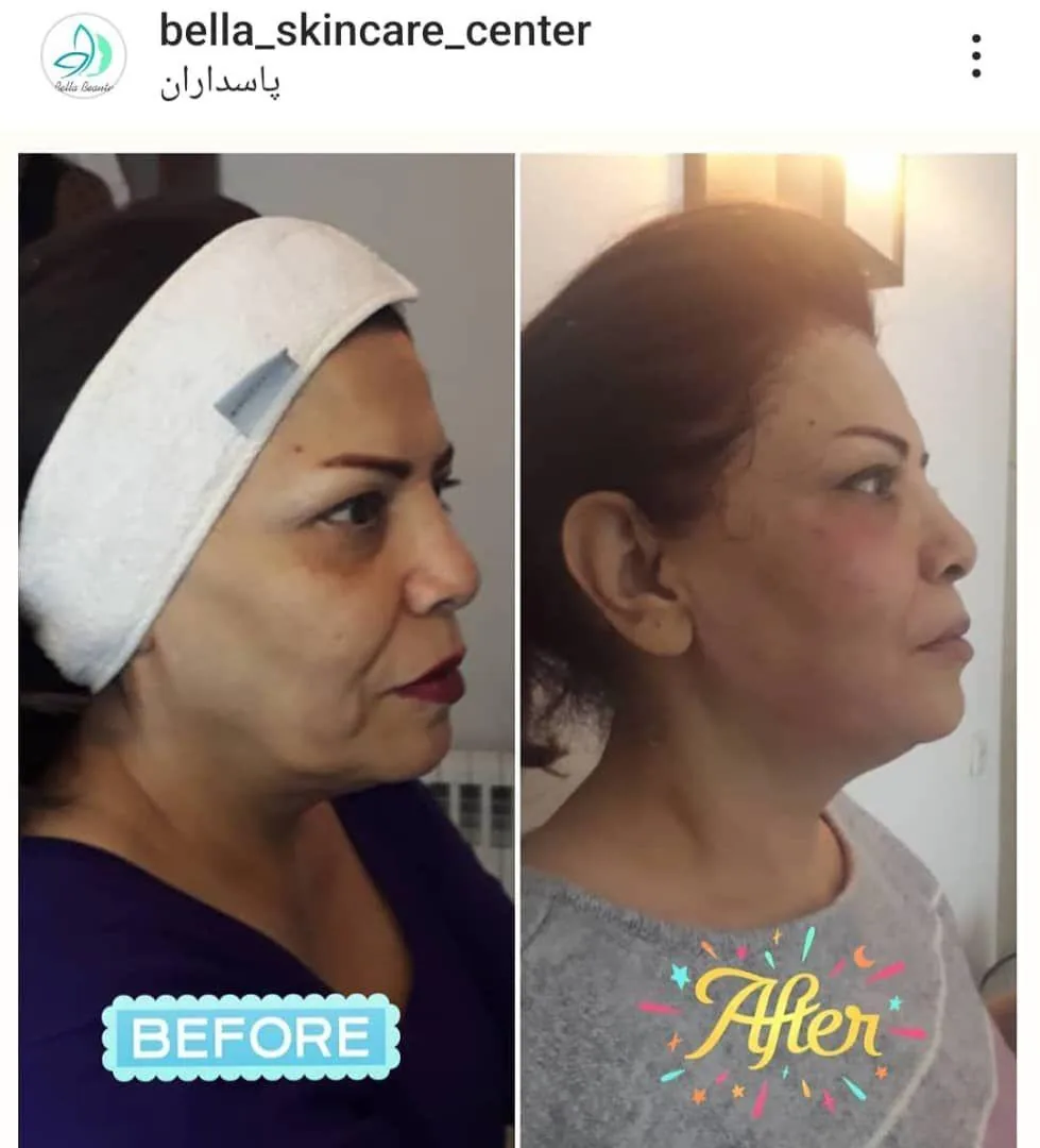 بیوتی تراپیست بلا - تصویر 2