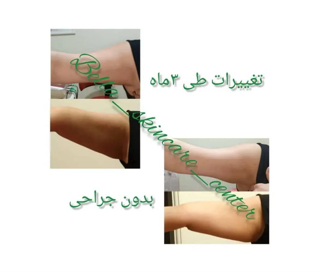 بیوتی تراپیست بلا - تصویر 3