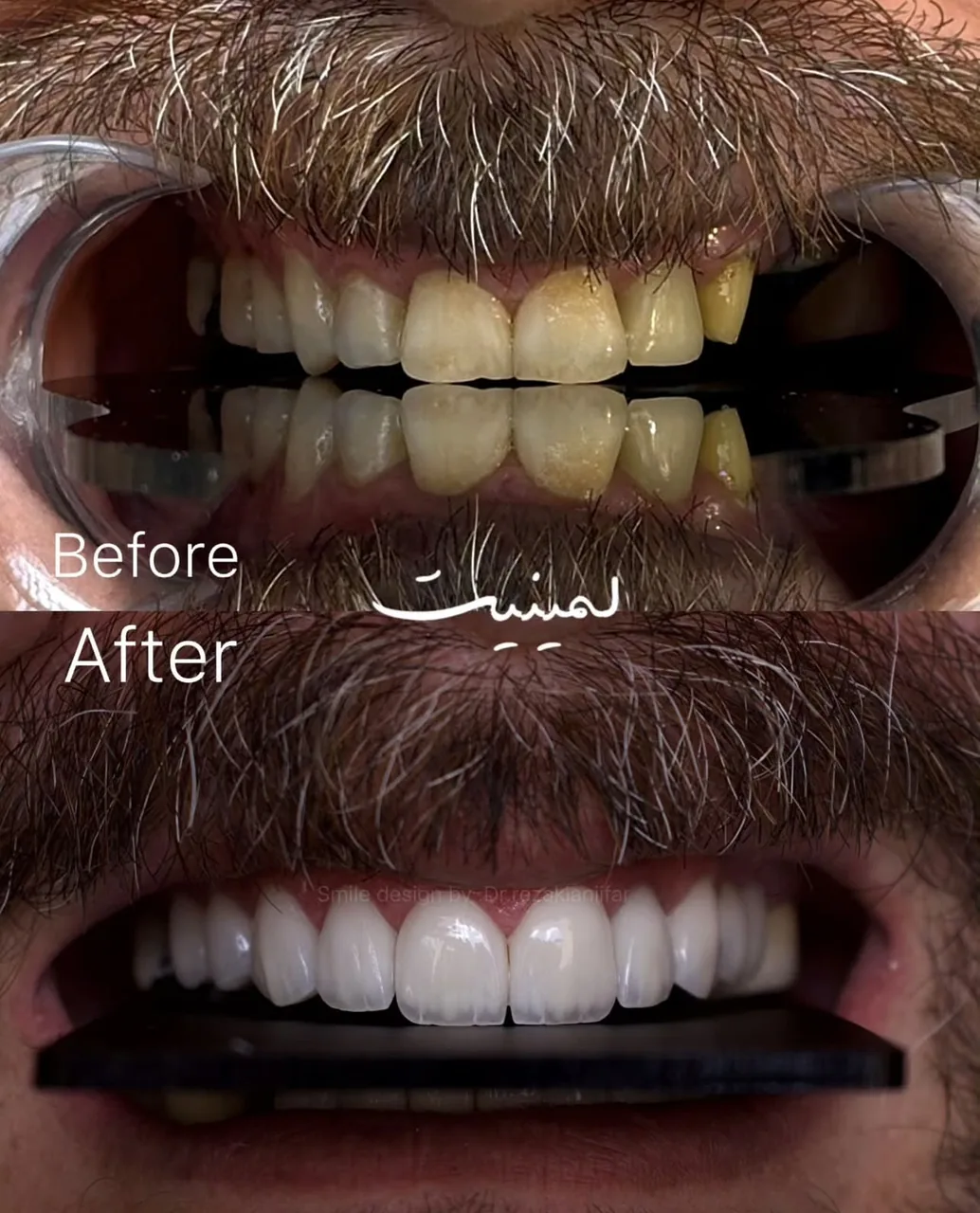 کلینیک دندانپزشکی مانا دنت ایمپلنت - تصویر 4