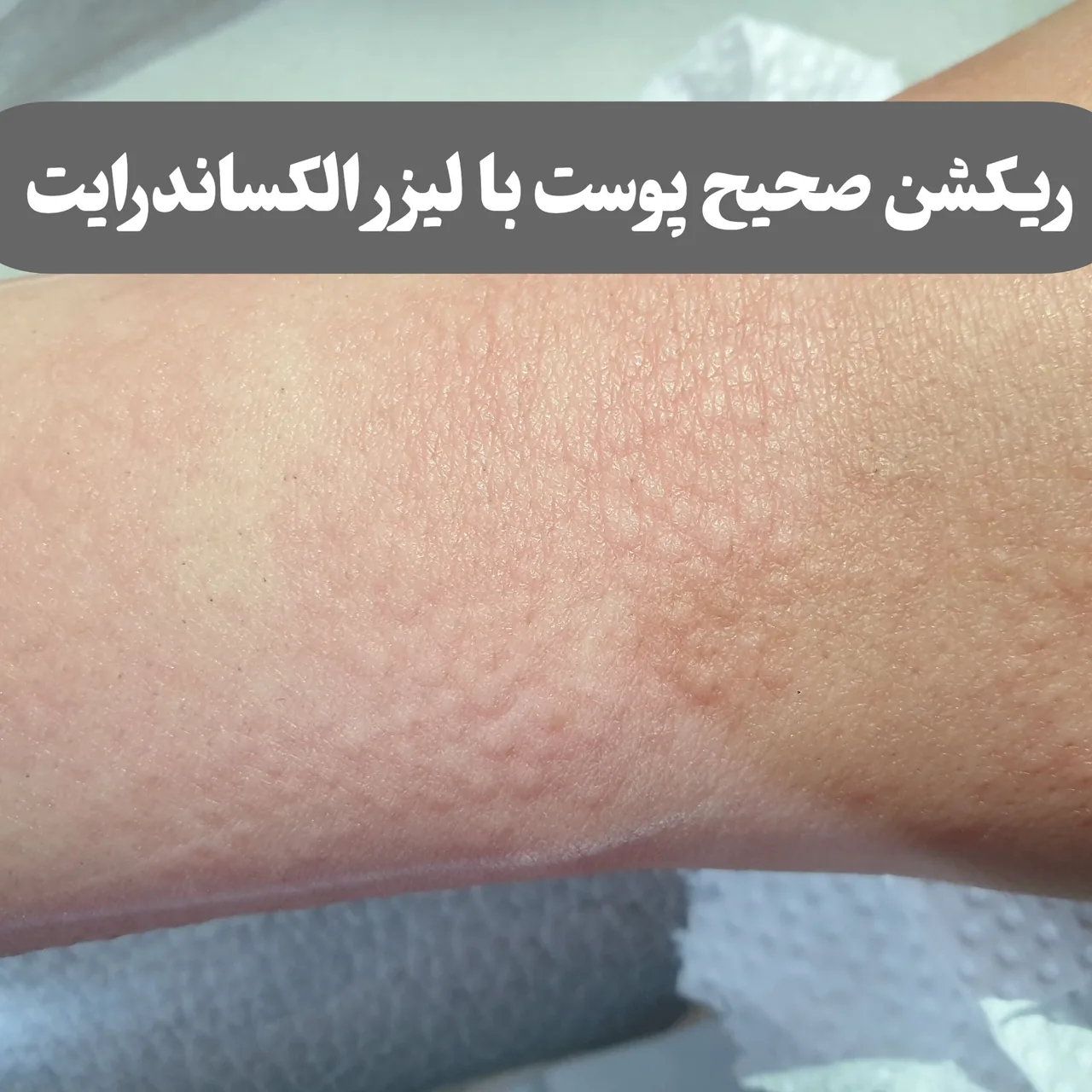 مرکز لیزر زیبایی گیسو (شریعتی میرداماد) - تصویر 2