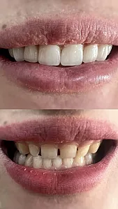 مرکز دندانپزشکی و دندانسازی اشراق