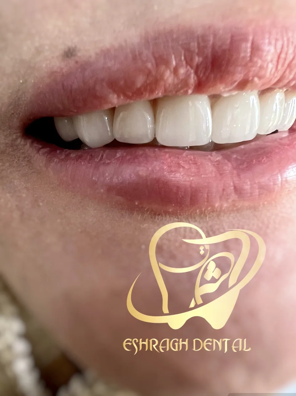مرکز دندانپزشکی و دندانسازی اشراق - تصویر 2