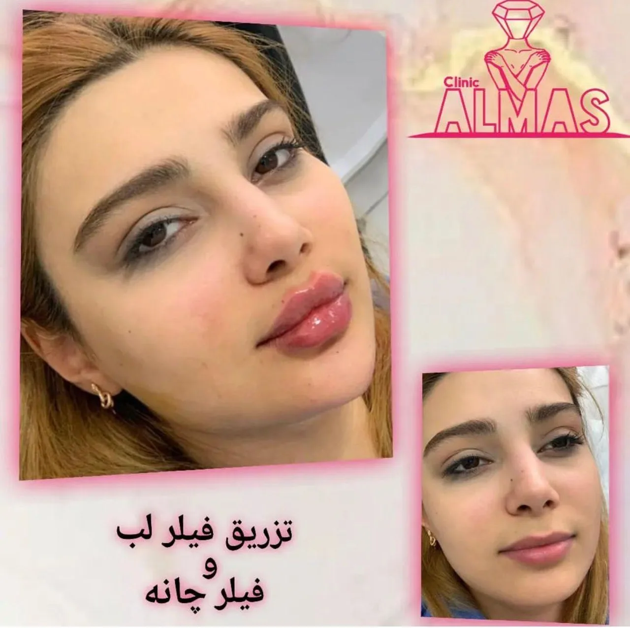 کلینیک تخصصی پوست و زیبایی و لیزر الماس