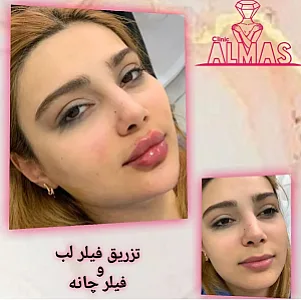کلینیک تخصصی پوست و زیبایی و لیزر الماس