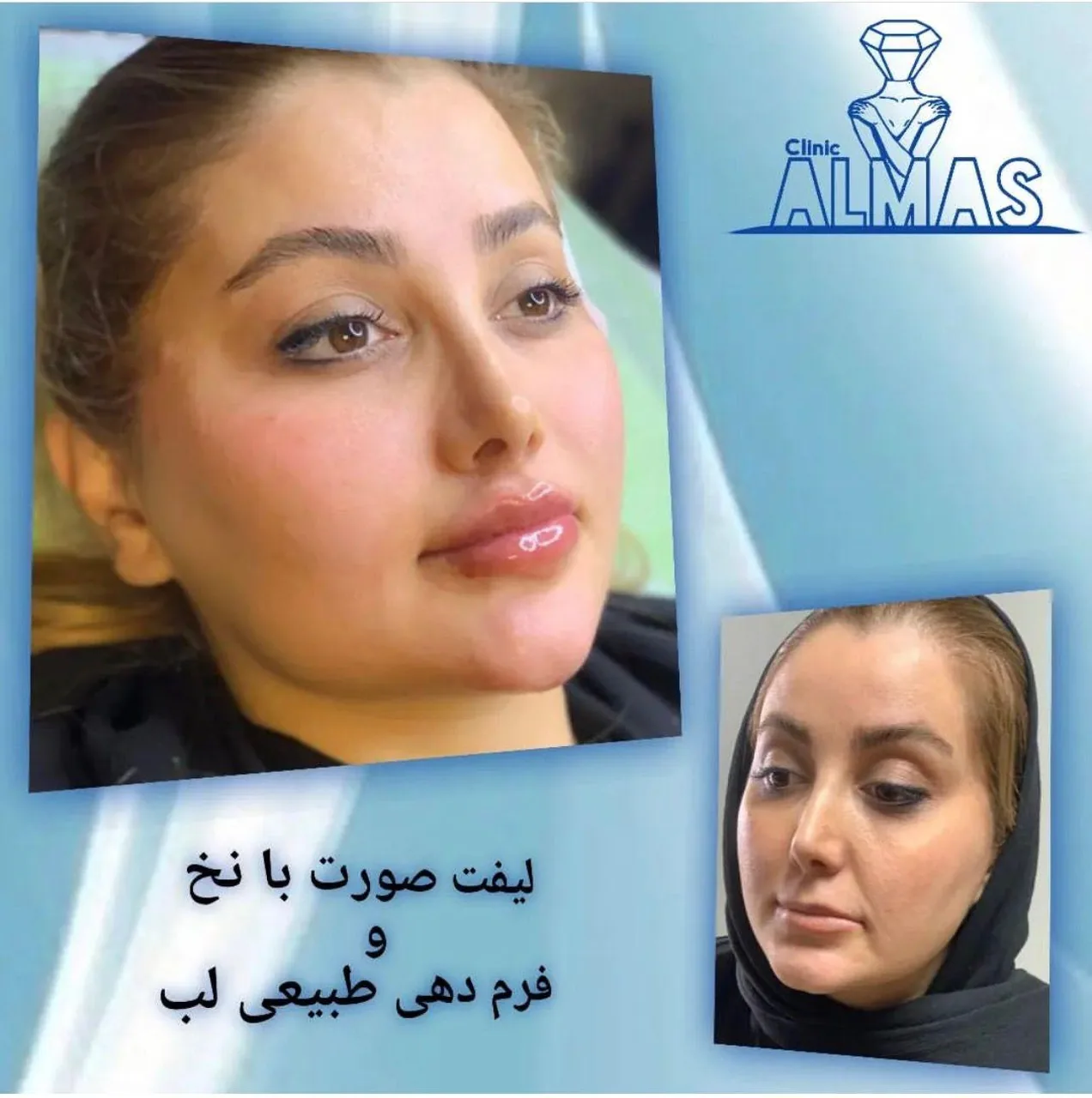 کلینیک تخصصی پوست و زیبایی و لیزر الماس - تصویر 2
