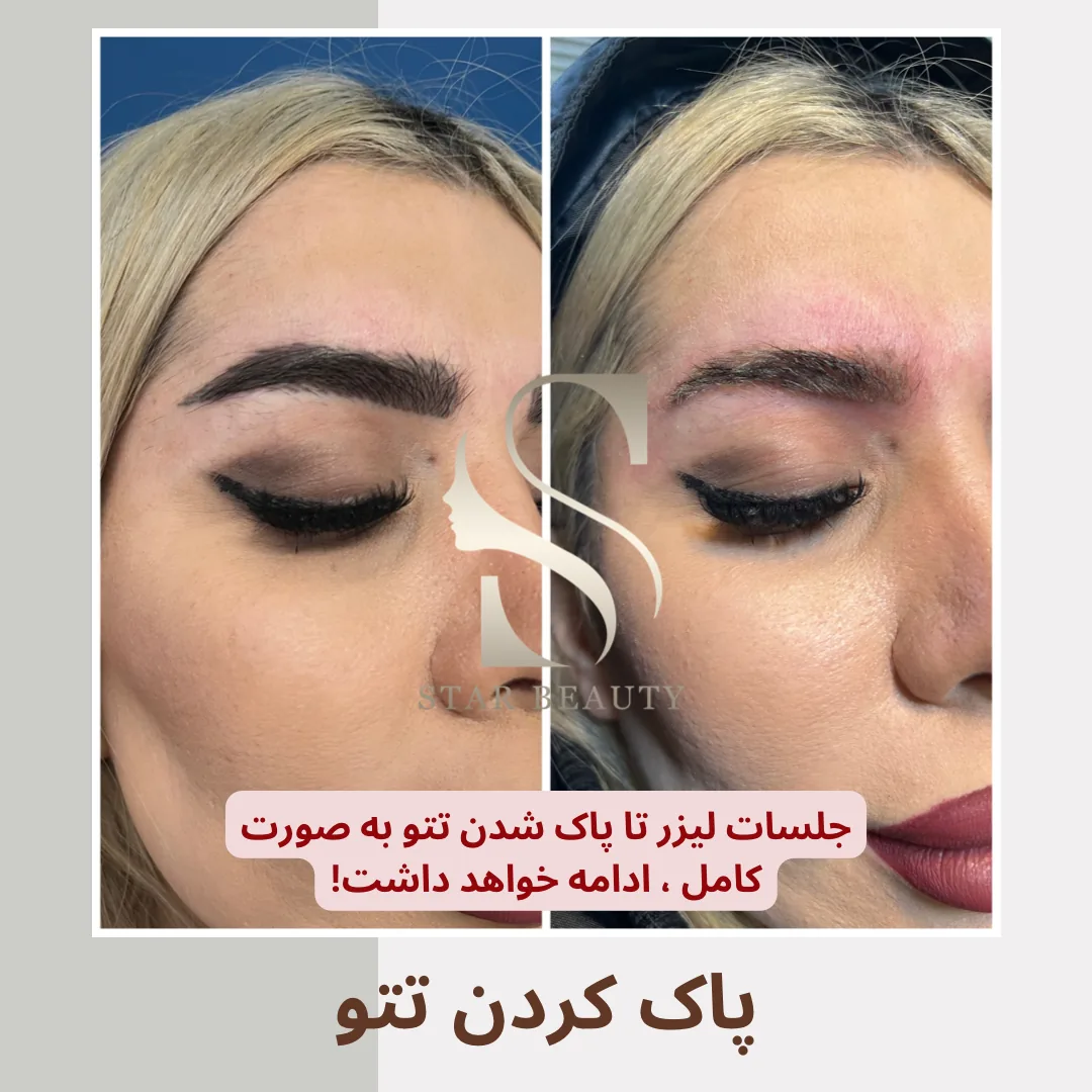 کلینیک زیبایی استاربیوتی - تصویر 2
