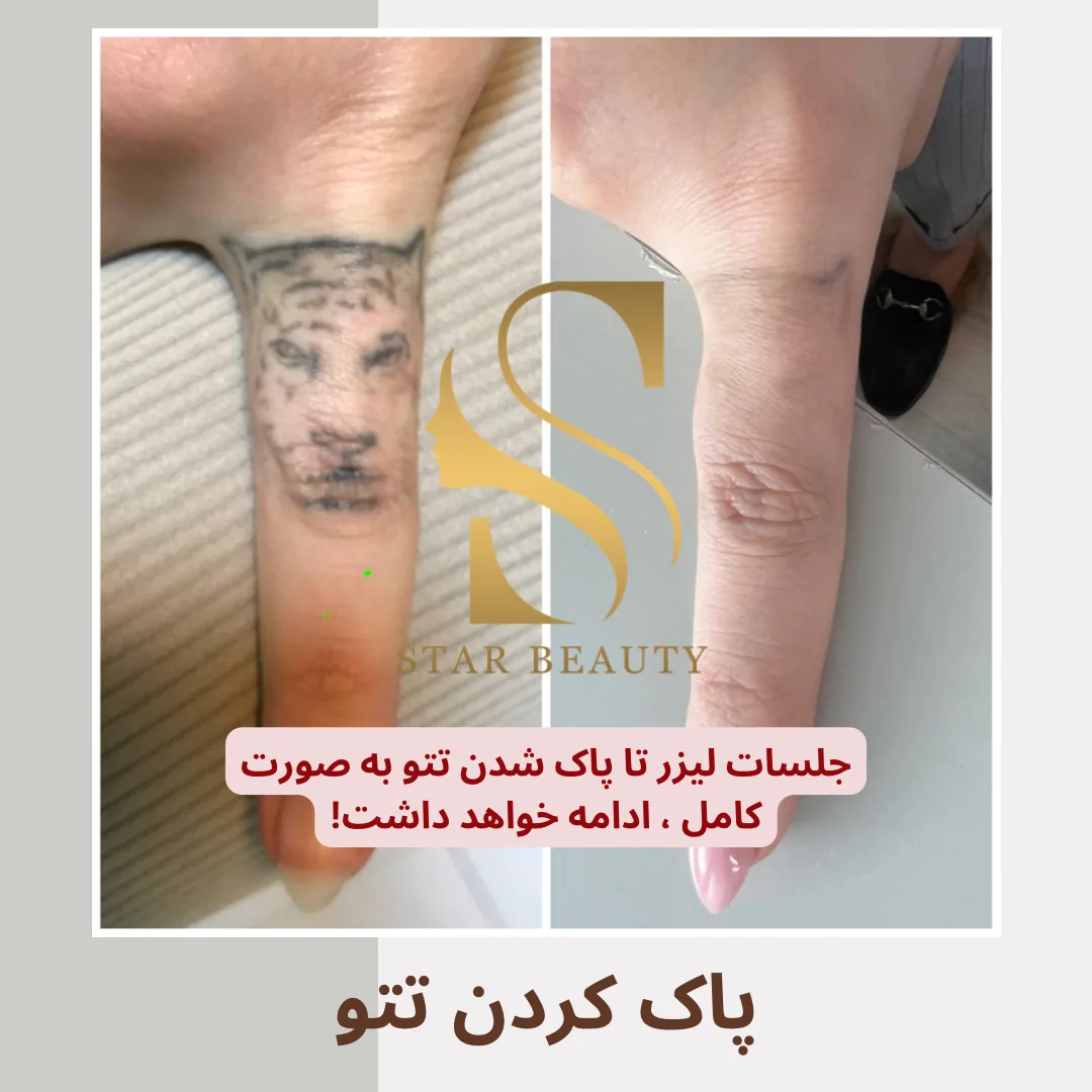 کلینیک زیبایی استاربیوتی - تصویر 3
