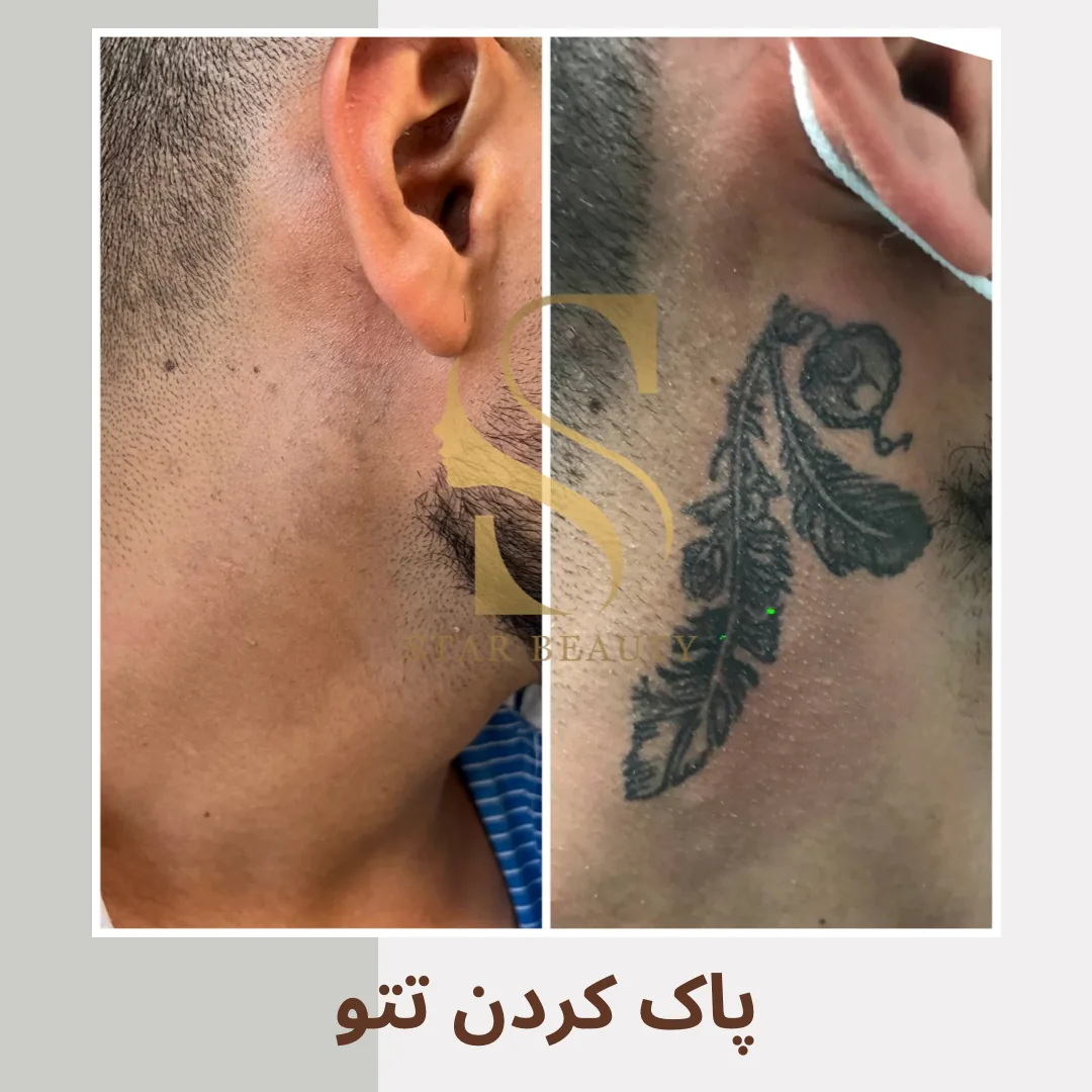 کلینیک زیبایی استاربیوتی - تصویر 4