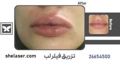 کلینیک زیبایی و لیزر پارادایس - تصویر 2