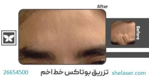 کلینیک زیبایی و لیزر پارادایس - تصویر 3