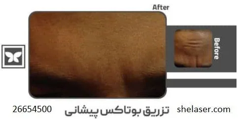 کلینیک زیبایی و لیزر پارادایس - تصویر 4