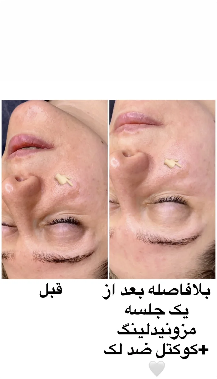 فیشال و پاکسازی تخصصی حنانه وقاری - تصویر 2