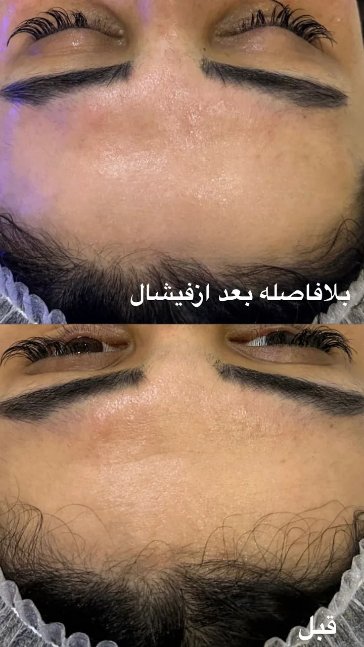 فیشال و پاکسازی تخصصی حنانه وقاری - تصویر 3