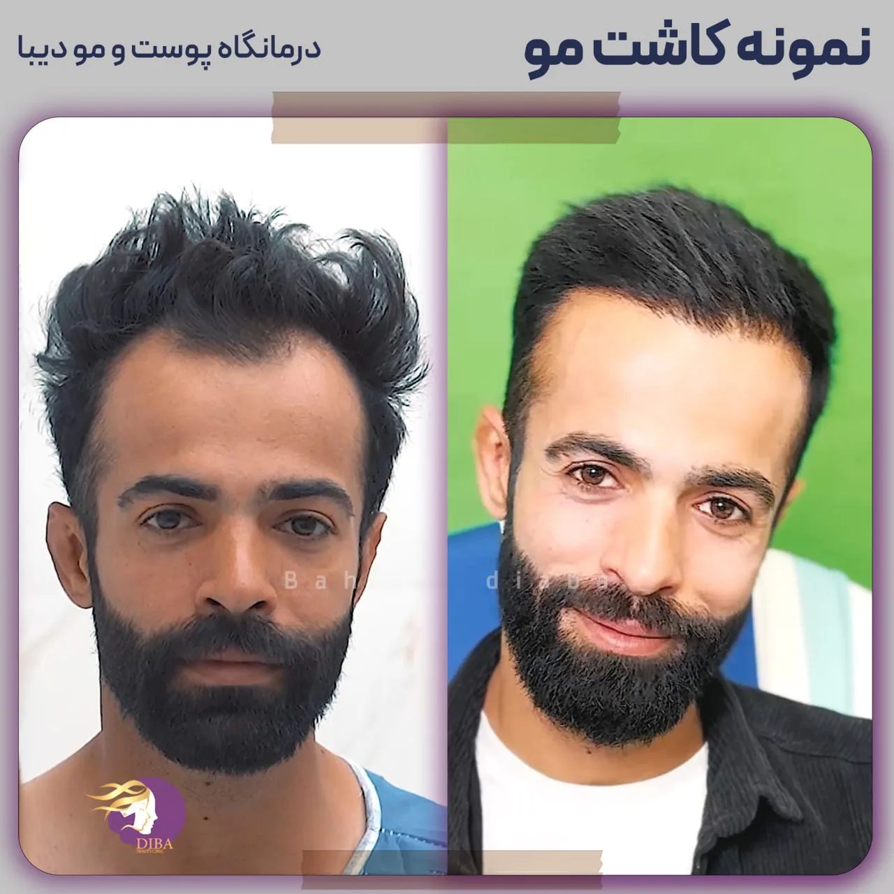 کلینیک زیبایی بهار دیبا - تصویر 3