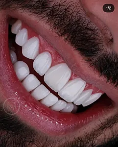 کلینیک دندانپزشکی اکسیر