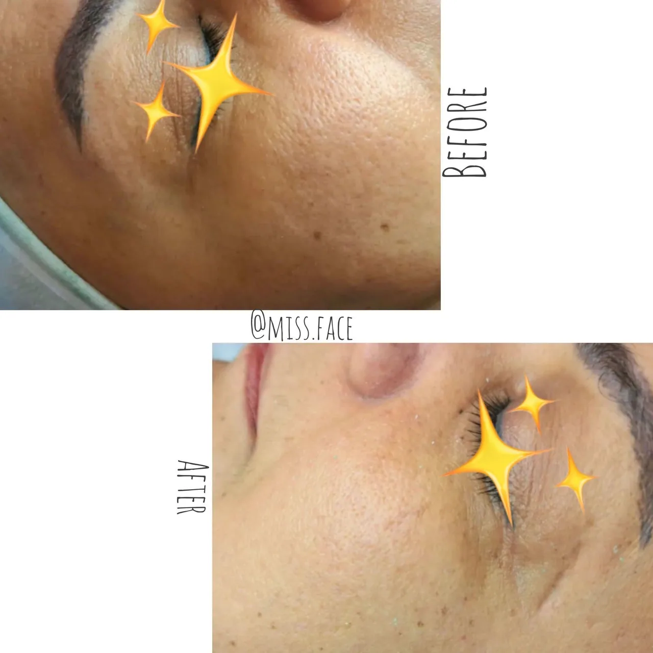 پاکسازی پوست بانوانmissFace - تصویر 4
