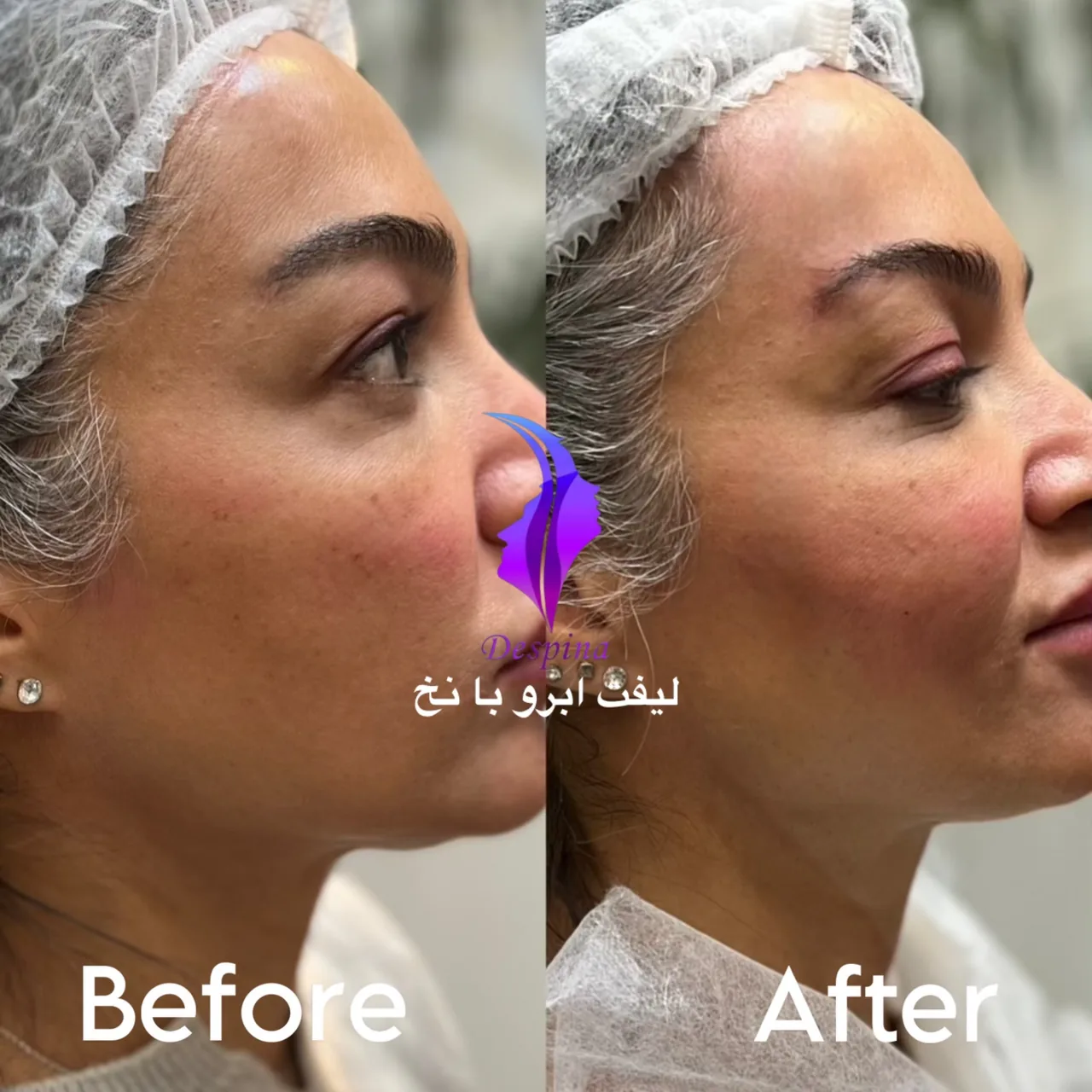 کلینیک زیبایی و کاشت مو دسپینا - تصویر 2