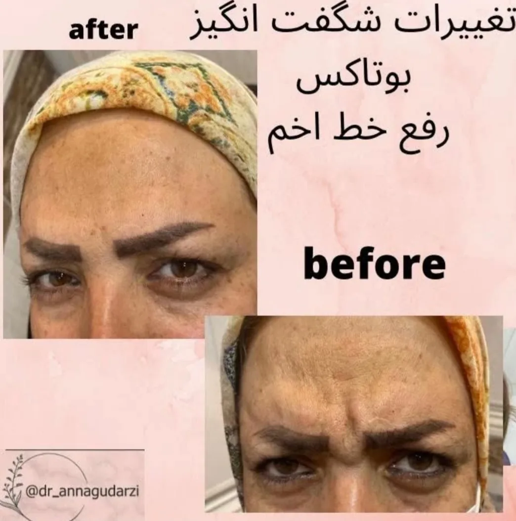 کلینیک زیبایی تزریق ژل بوتاکس و لیزر آنا - تصویر 2