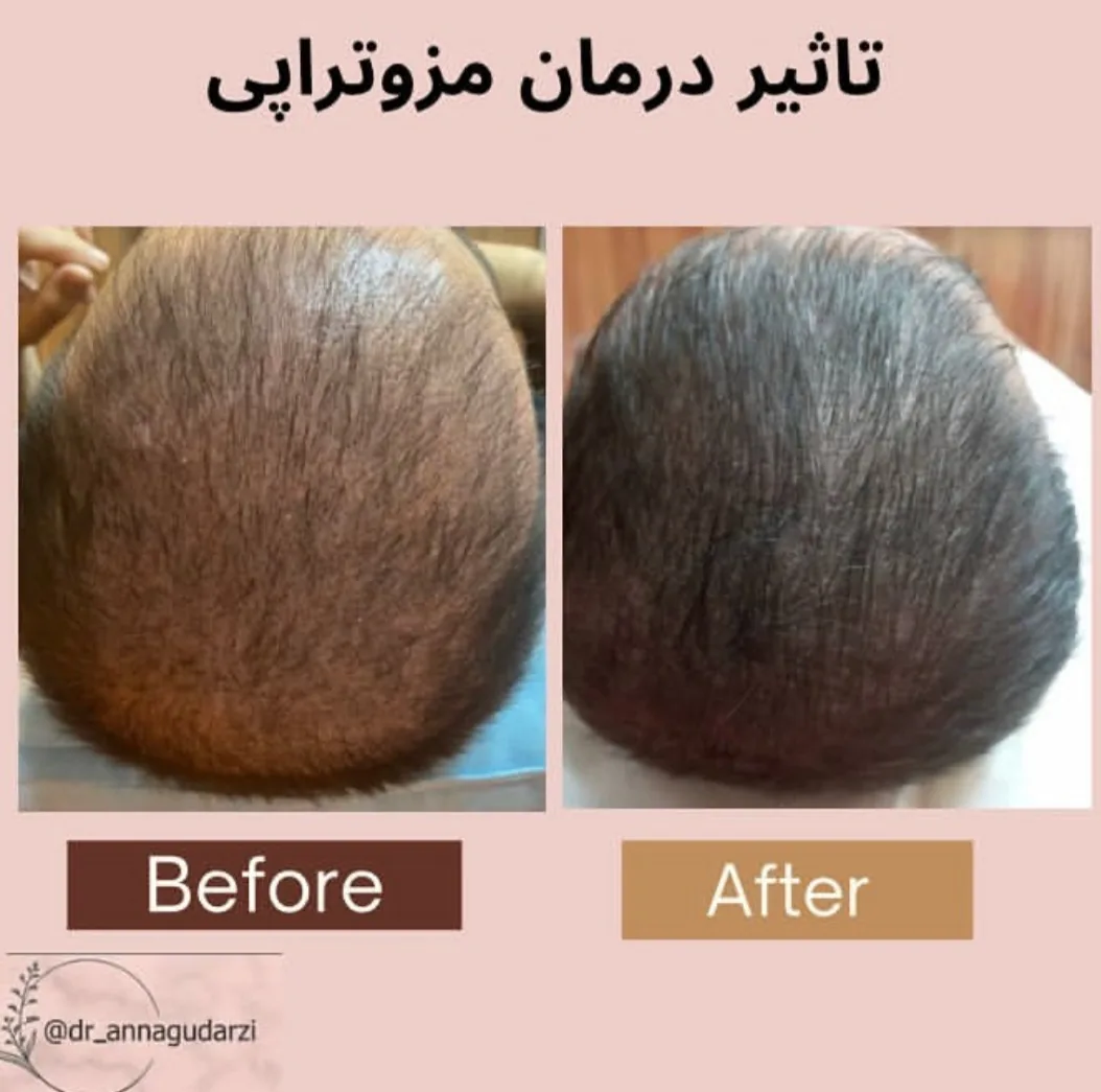 کلینیک زیبایی تزریق ژل بوتاکس و لیزر آنا - تصویر 3