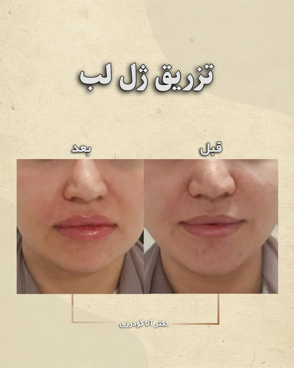 کلینیک زیبایی تزریق ژل بوتاکس و لیزر آنا - تصویر 4