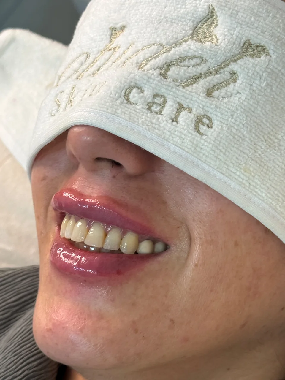 کلینیک لیزر و زیبایی نیلماه - تصویر 3
