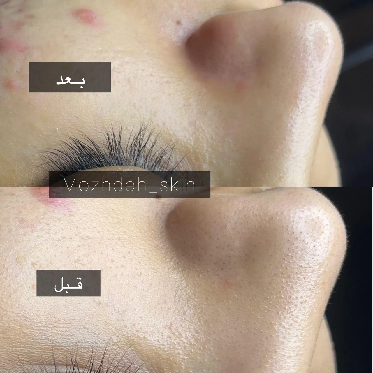بیوتی تراپیست مژده حقیقت - تصویر 3