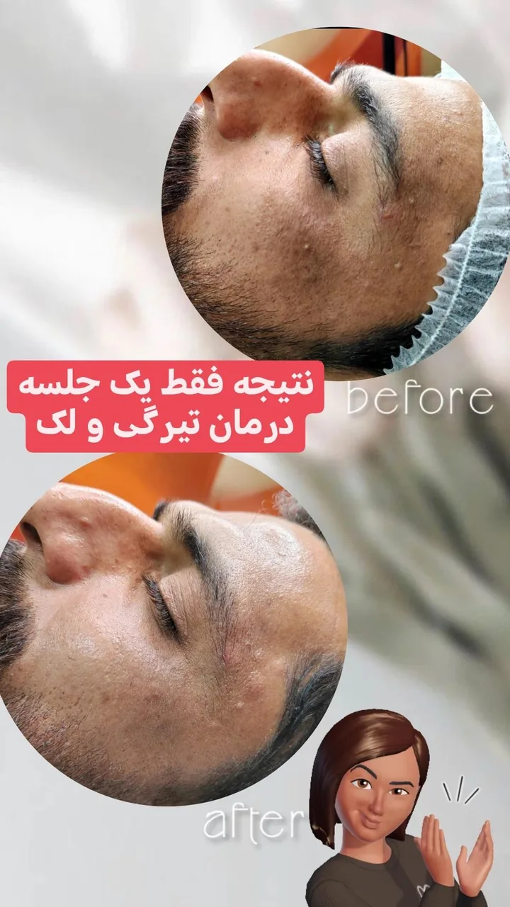 ماساژ، لاغری، پاکسازی پوست و مو (دلاژین)