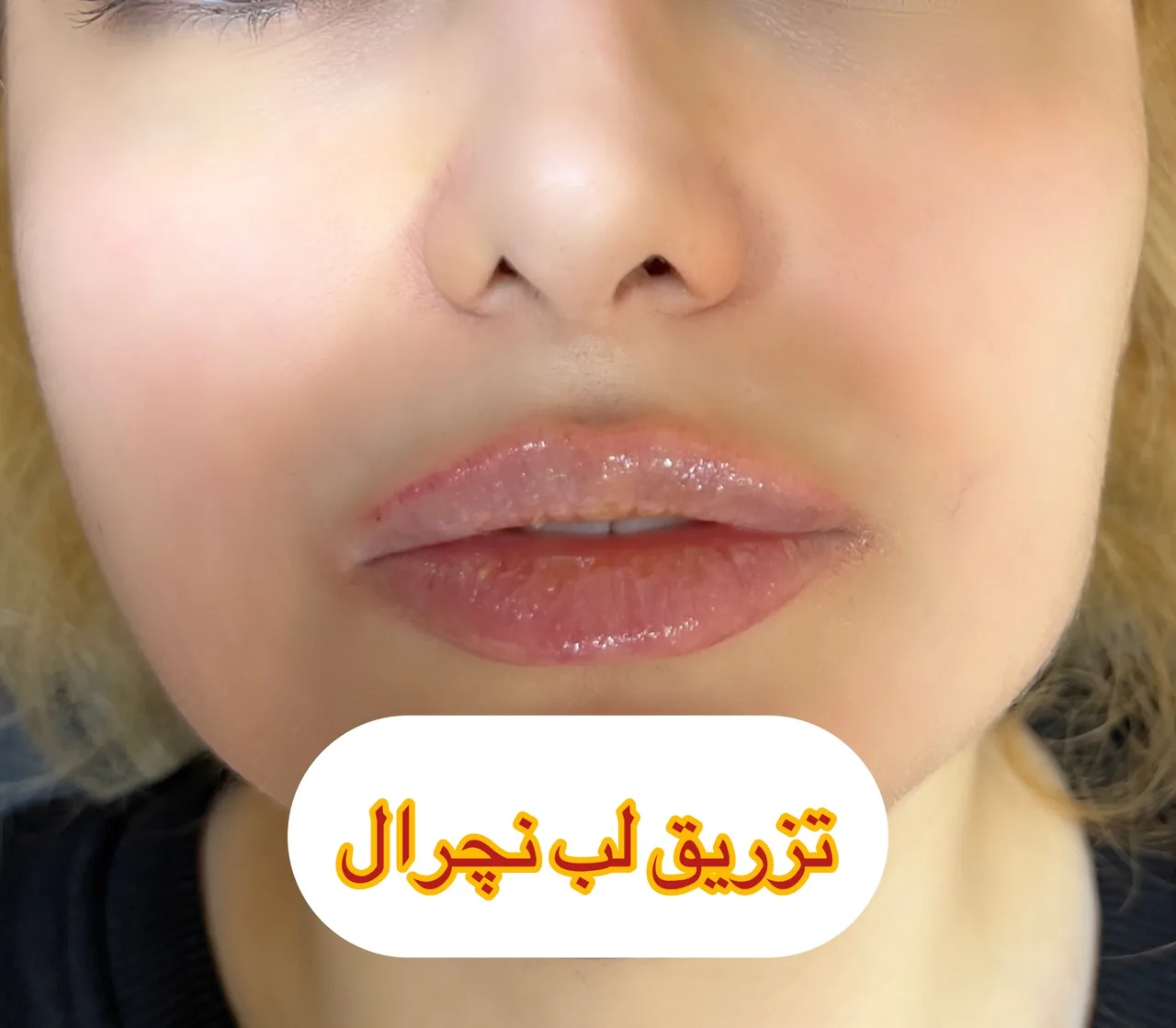 دکتر زیبایی حاجی زاده - تصویر 2