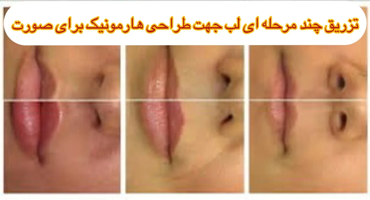 دکتر زیبایی حاجی زاده - تصویر 3