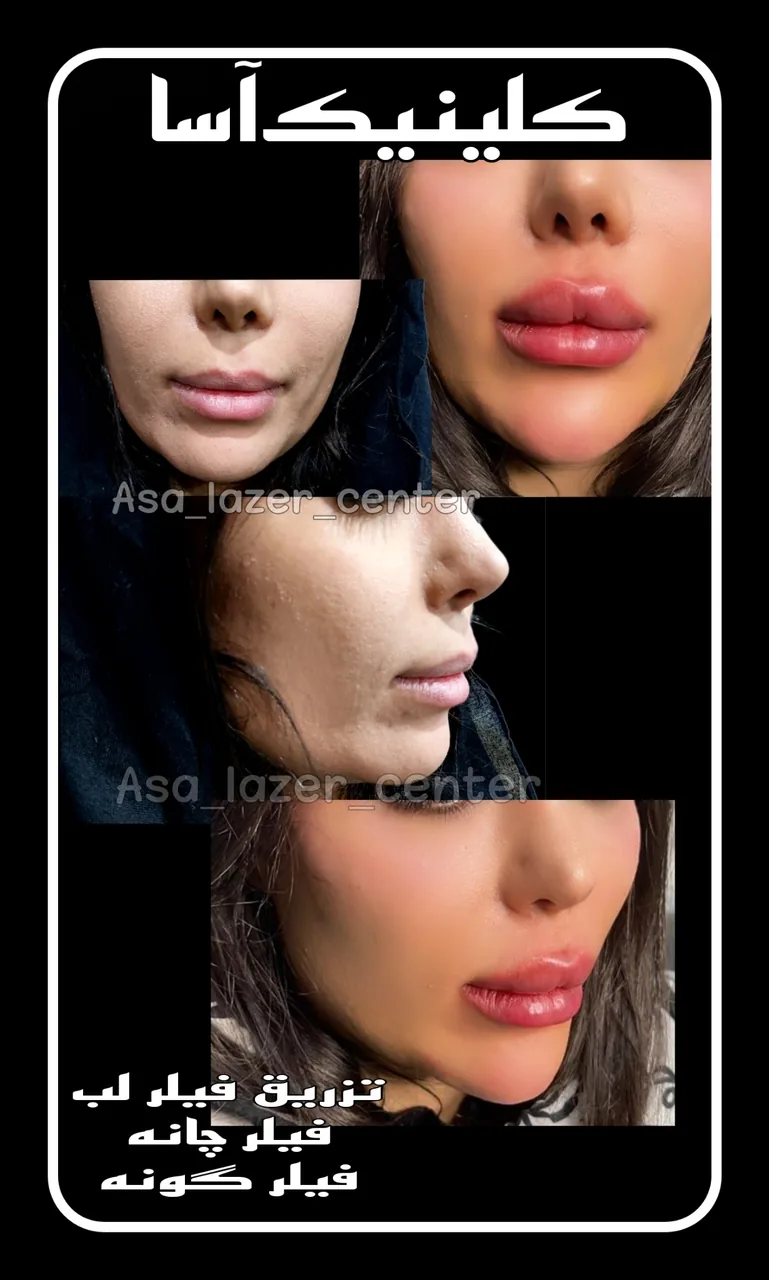 مرکزکلینیک لیزر زیبایی پوست و مو آسا - تصویر 2