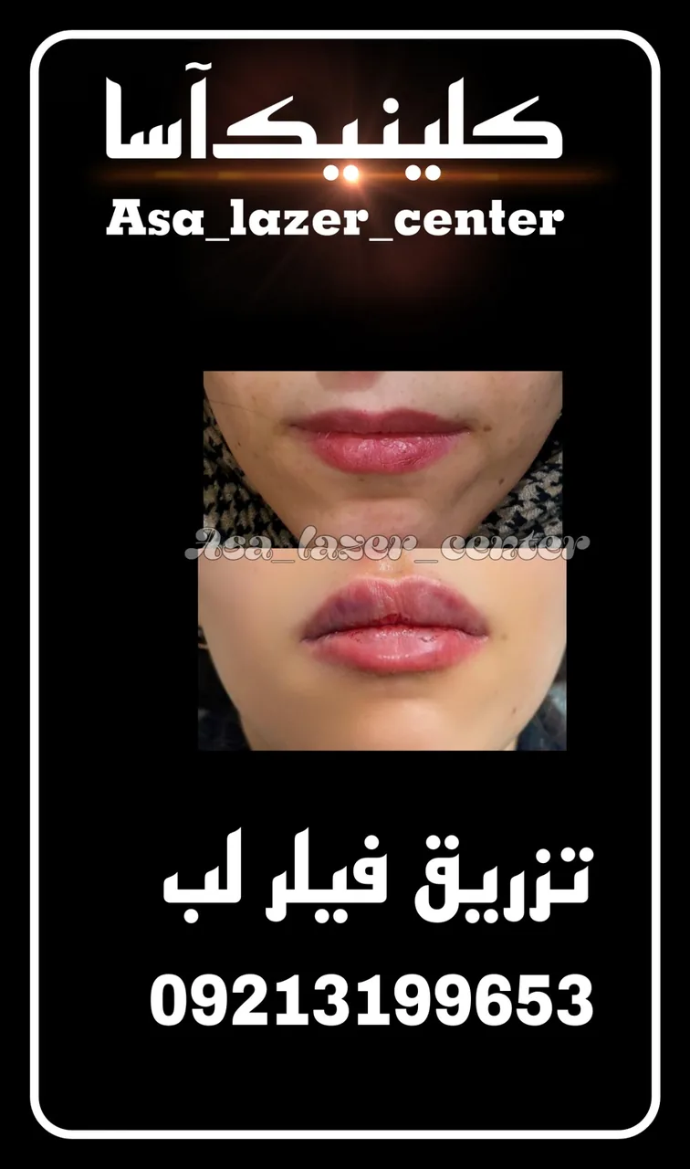 مرکزکلینیک لیزر زیبایی پوست و مو آسا - تصویر 3