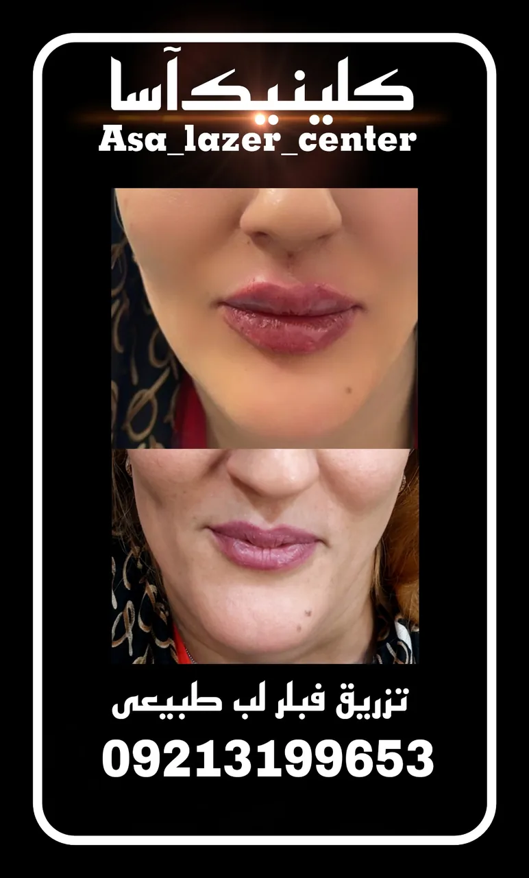 مرکزکلینیک لیزر زیبایی پوست و مو آسا - تصویر 4