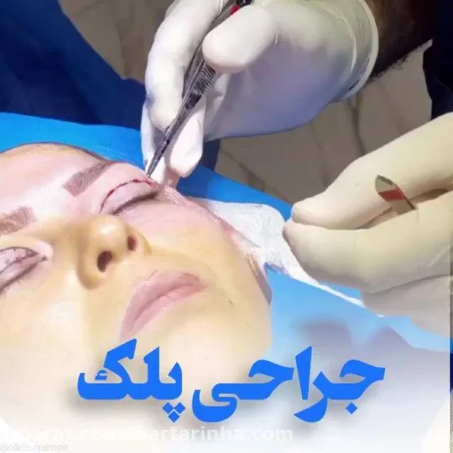 کلینیک تخصصی پوست و مو اورانوس - تصویر 4