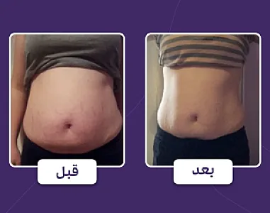 کلینیک لیزر و لاغری عصر زیبایی