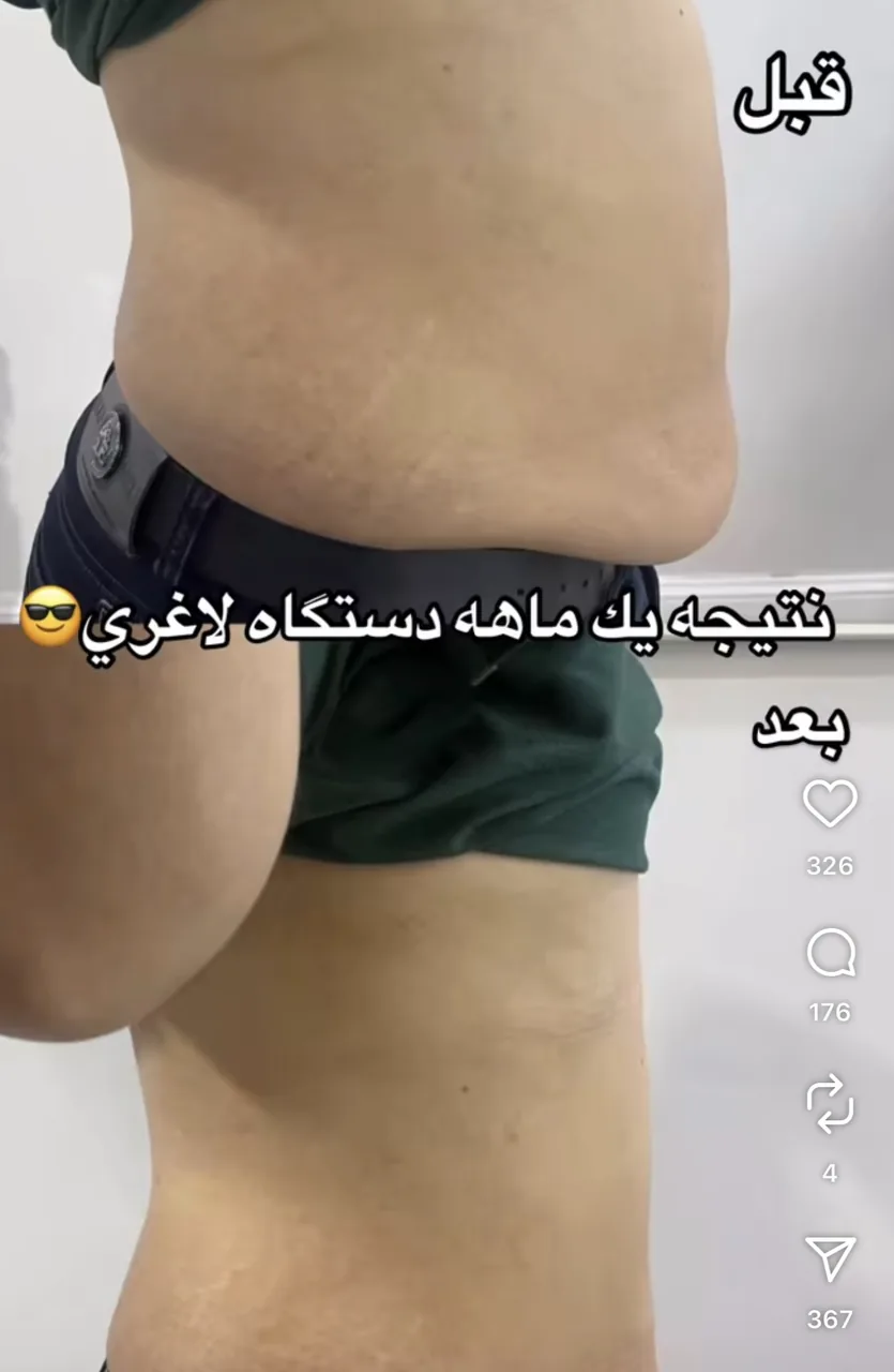 کلینیک لیزر و لاغری عصر زیبایی - تصویر 2