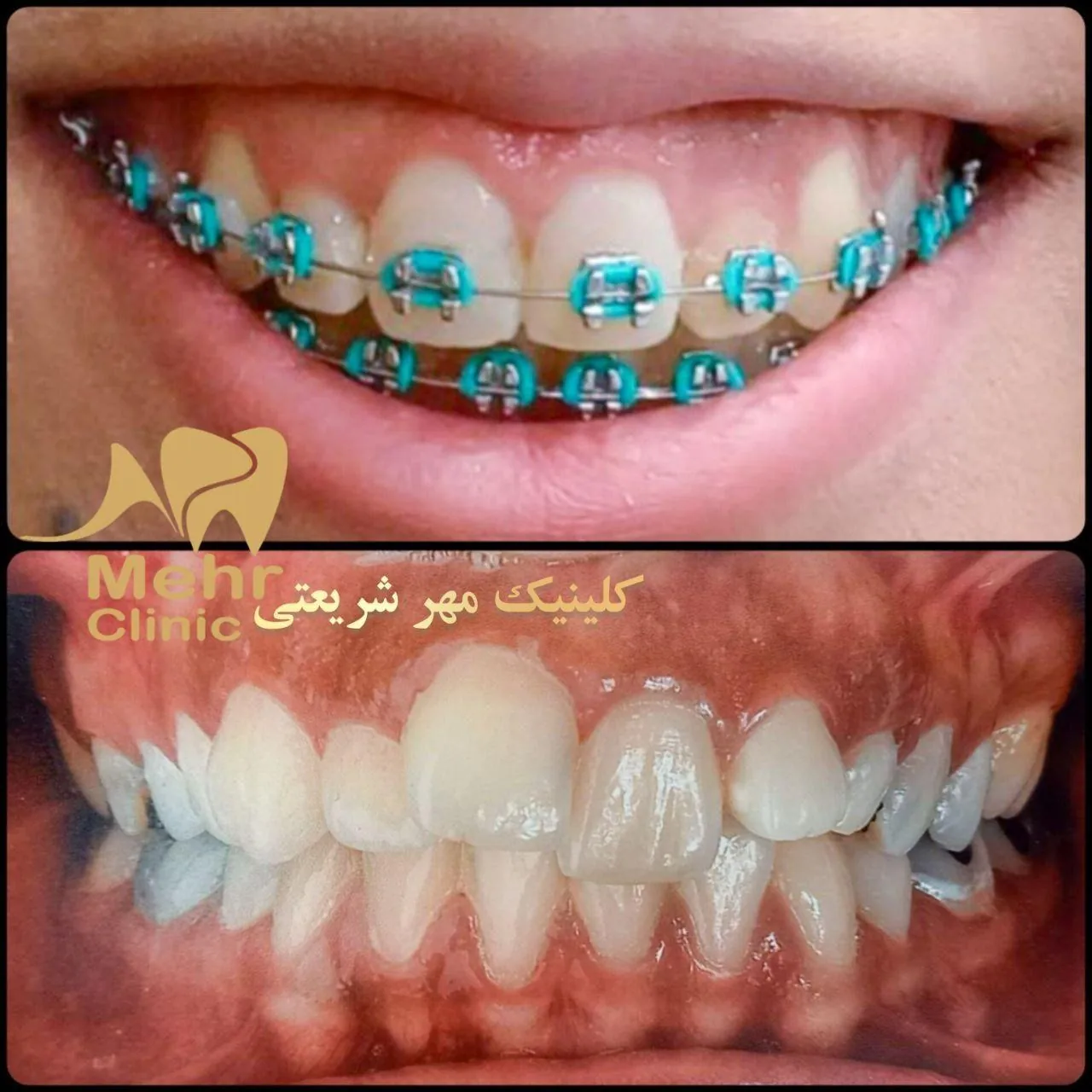 کلینیک دندانپزشکی مهر شریعتی - تصویر 4