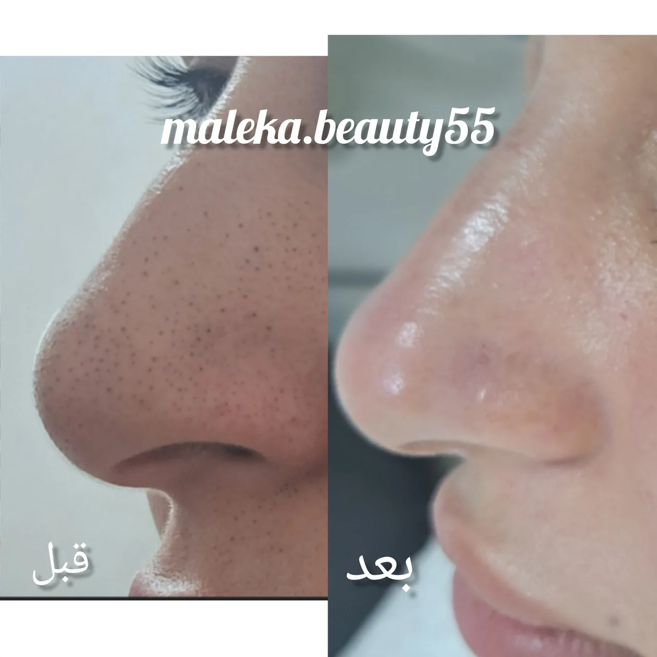 فشیال پاکسازی تخصصی ملکیا سلیمی - تصویر 2