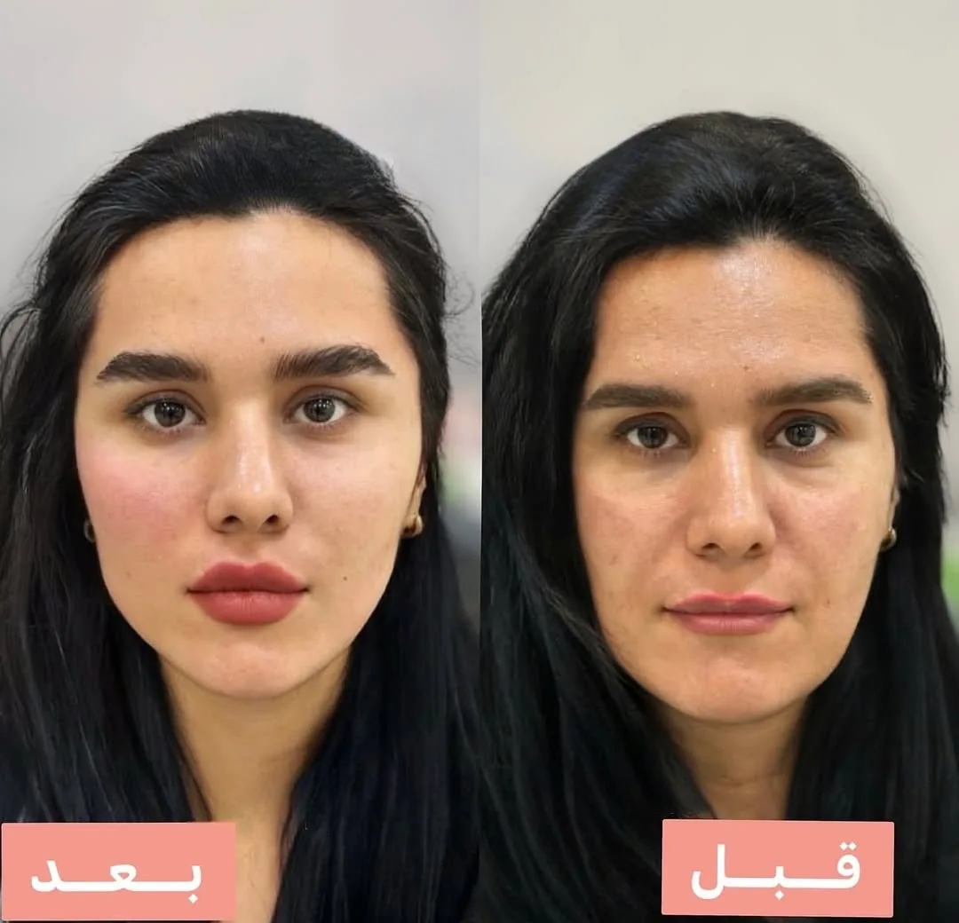 کلینیک تخصصی لیزر  زارا - تصویر 3
