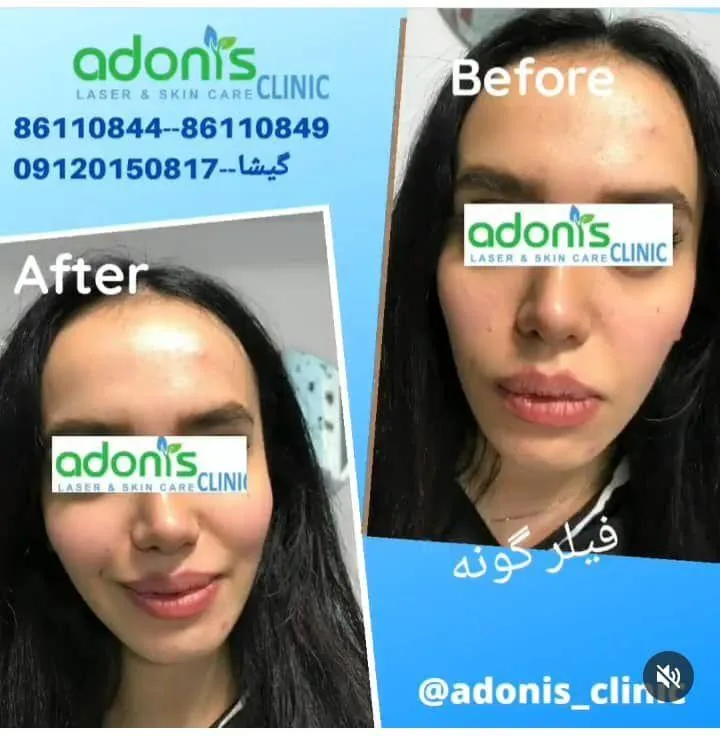 کلینیک پوست مو زیبایی و لیزر آدونیس - تصویر 2