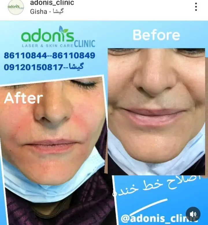 کلینیک پوست مو زیبایی و لیزر آدونیس - تصویر 3