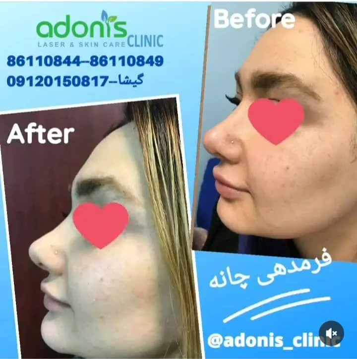 کلینیک پوست مو زیبایی و لیزر آدونیس - تصویر 4