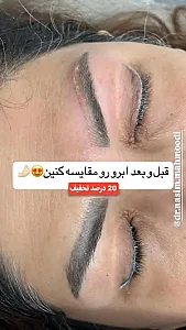 لیزر،پوست،مو(منطقه ۷ تهران)دکتر محمودی