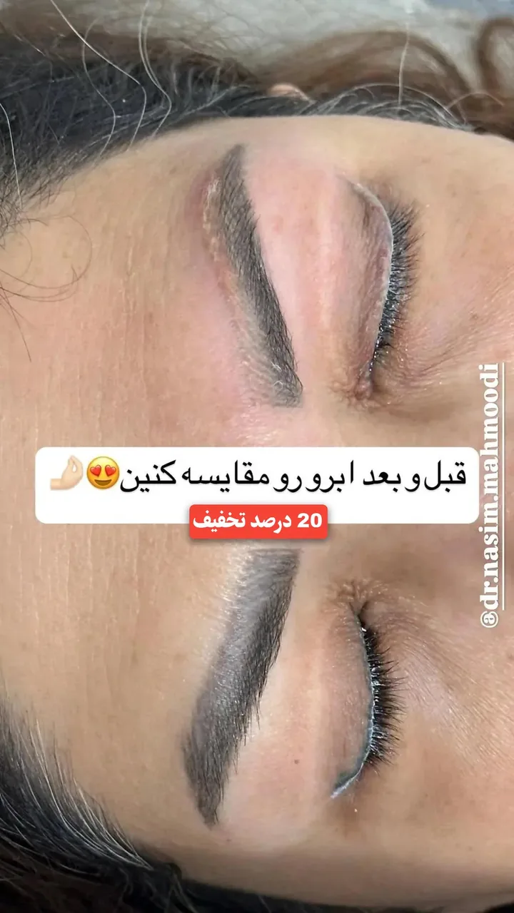 لیزر،پوست،مو(منطقه ۷ تهران)دکتر محمودی
