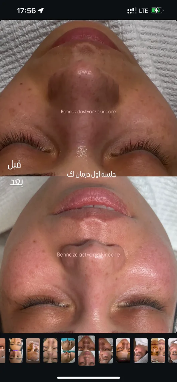 مرکز حرفه ای فیشال و پوست بهناز دست ورز - تصویر 4