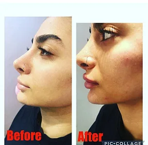 مرکز لاغری و کلینیک لاغری فوق سریع مقدم