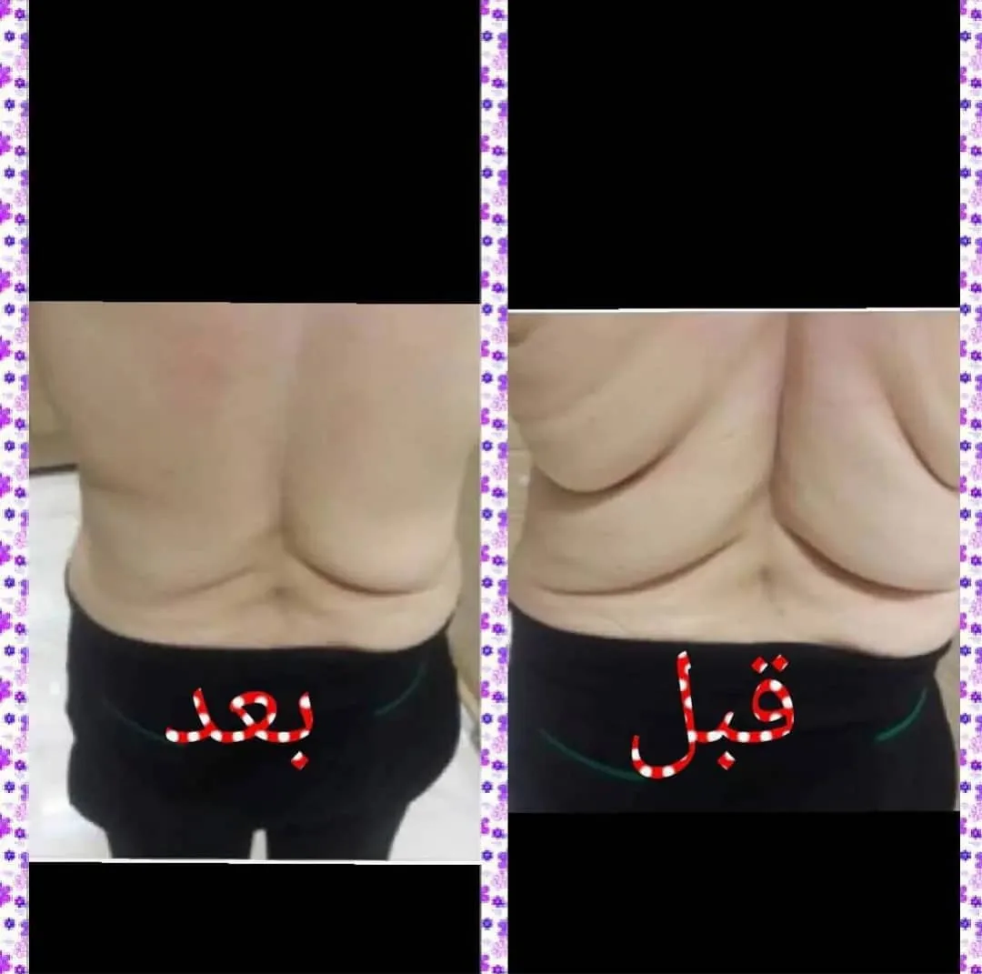 ماساژ و پاکسازی پوست و ماساژ لاغری برکت