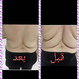 ماساژ و پاکسازی پوست و ماساژ لاغری برکت