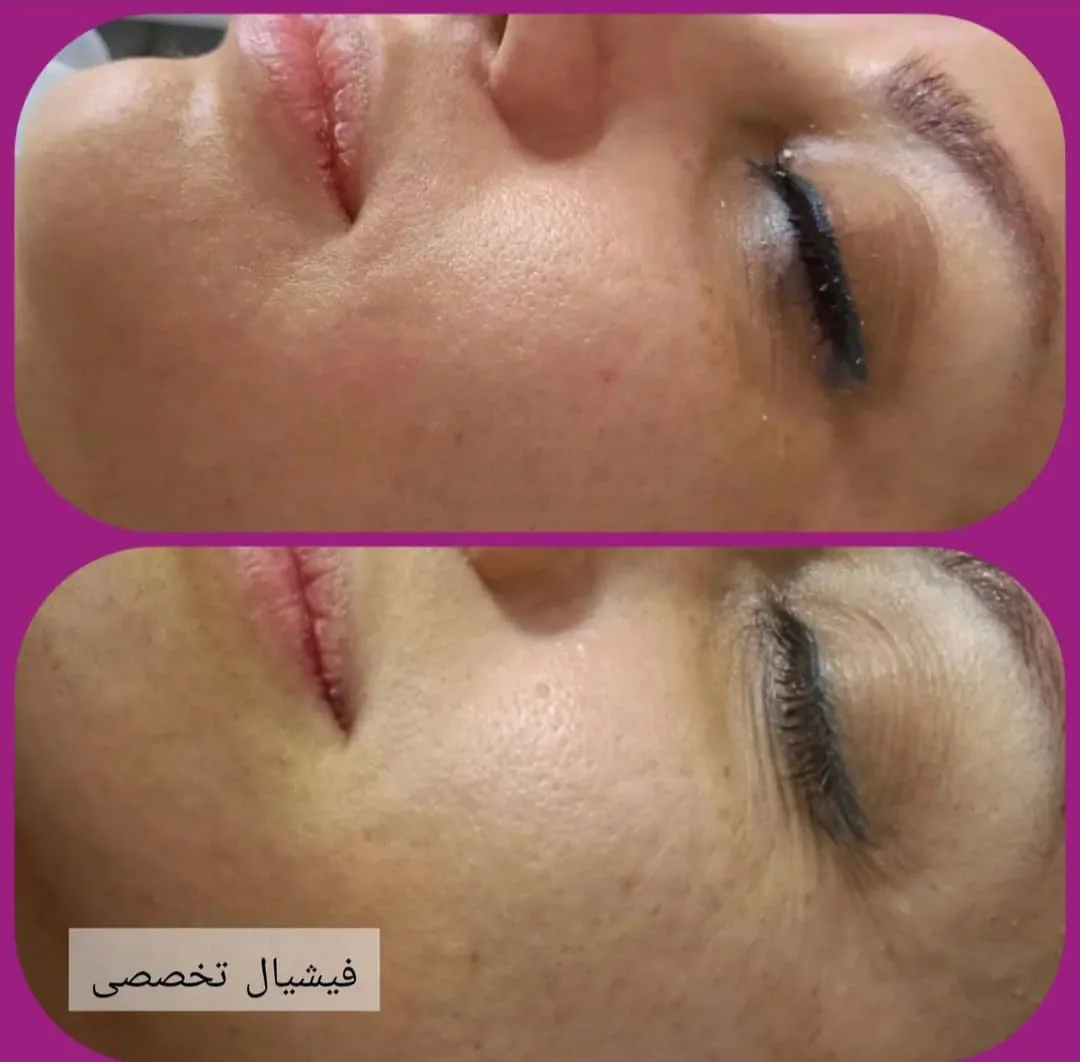 ماساژ و پاکسازی پوست و ماساژ لاغری برکت - تصویر 2