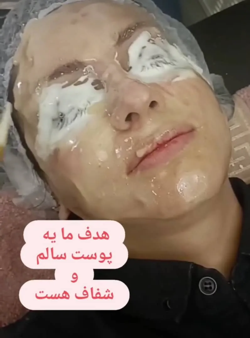 ماساژ و پاکسازی پوست و ماساژ لاغری برکت - تصویر 3
